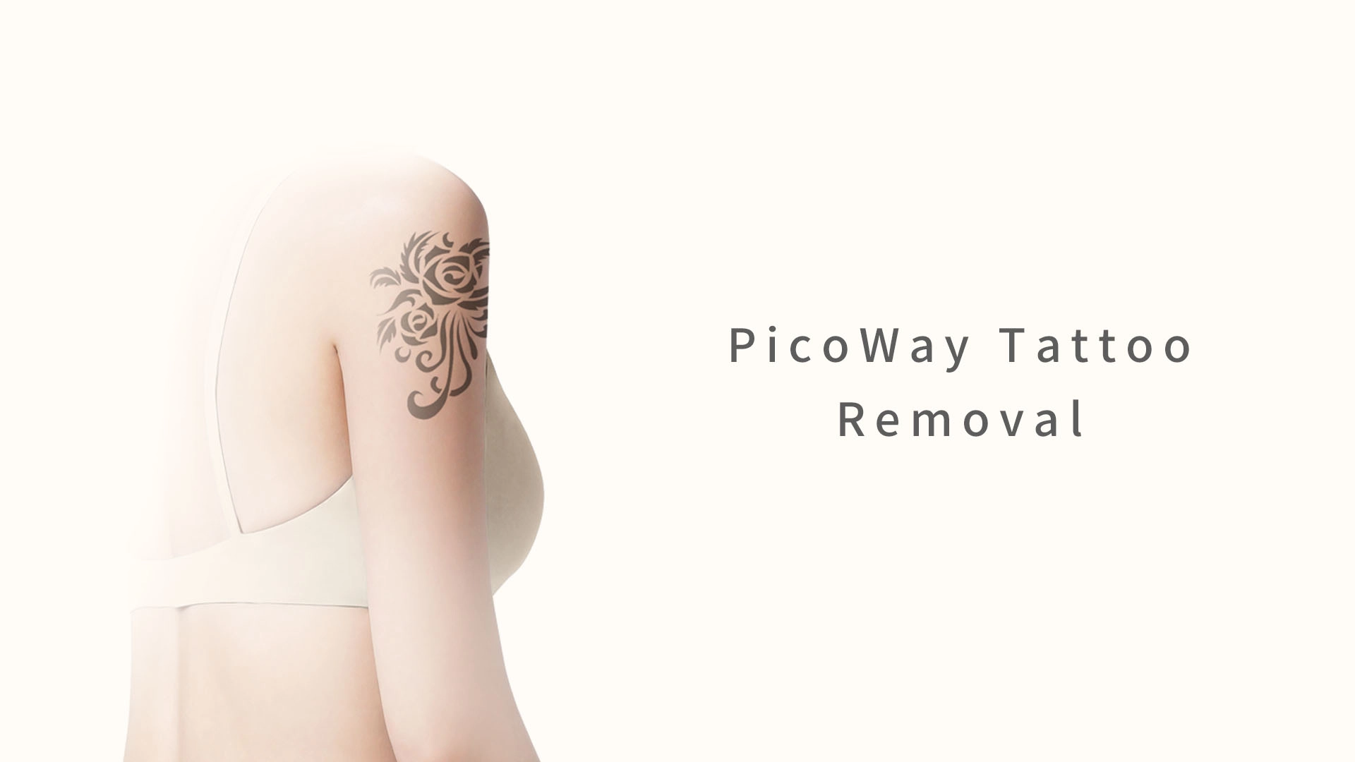 PicoWay Tattoo Removal